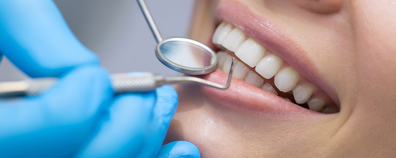 The Importance of Regular Dental Checkups: Why You Shouldn’t Skip Your Dentist Visits